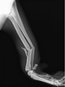 大型犬の撓尺骨粉砕骨折