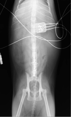 術後レントゲン